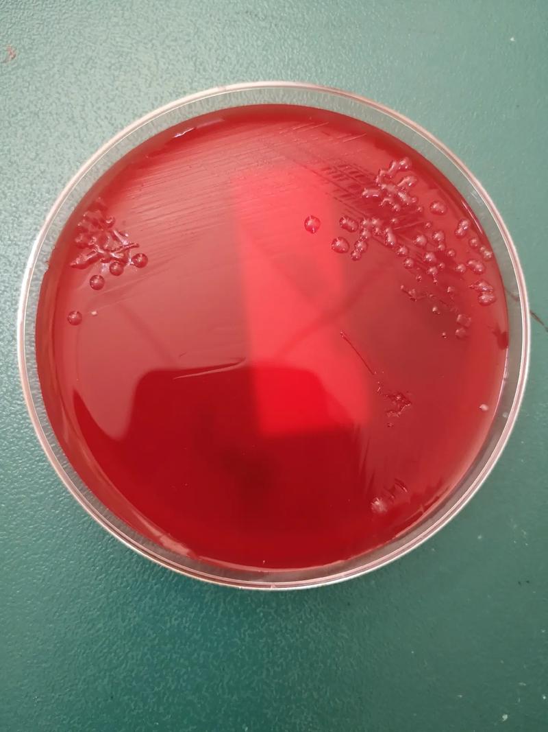 抗生素抑制现象中的浓度梯度效应 原始区抑菌与非原始区细菌生长的机制解析